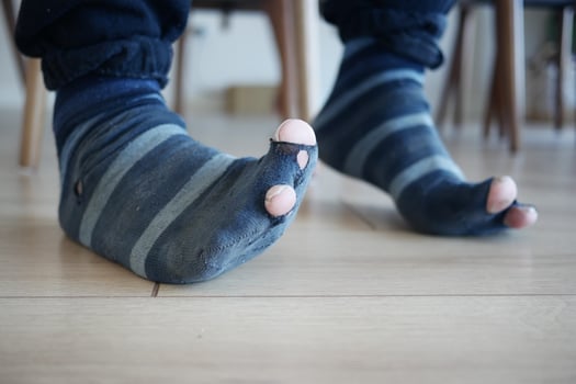 men feet with dirty socks while sitting on sofa photo