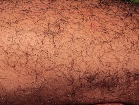 Hair on human skin, shin of hairy man's leg photo