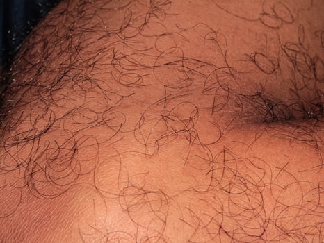 Hair on human skin, shin of hairy man's leg photo