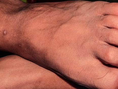 Male feet with clean white nails with brown skin color photo