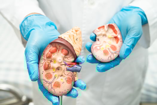 Kidney disease, Chronic kidney disease ckd, Doctor hold human model to treat and study in hospital. photo