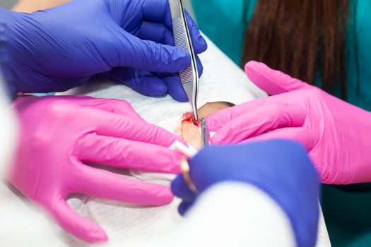 Doctor suturing a patient during a small surgery. Dermatologist carrying out a removal of benign skin lesion on the face of a young male patient. photo