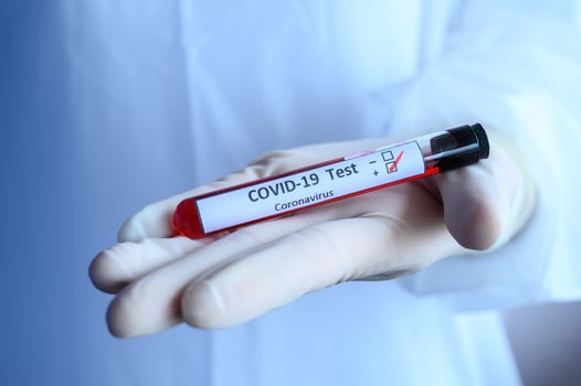 Close up of scientist doctor hand holding a sample test tube with blood for 2019-nCoV analyzing. photo