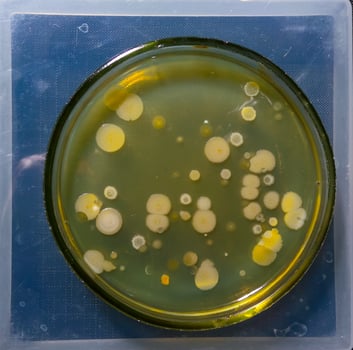 Colonies of pathogenic bacteria in a Petri dish, microbiological studies photo