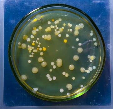 Colonies of pathogenic bacteria in a Petri dish, microbiological studies photo