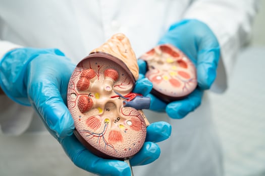 Kidney disease, Chronic kidney disease ckd, Doctor hold human model to treat and study in hospital. photo