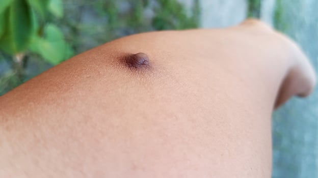 Lumps on the hands, bumps on skin photo