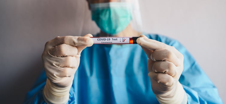 Scientist doctor wearing medical scrubs and holding a sample test tube with blood for 2019-nCoV analyzing. photo