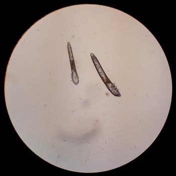 Demodex folliculorum - parasitic mite on the eyelashes of a human eye photo