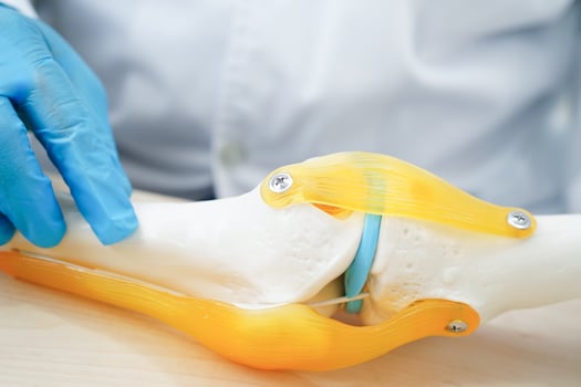 Asian doctor holding spinal nerve and bone model, Lumbar spine displaced herniated disc fragment for treatment medical in the orthopedic department. photo