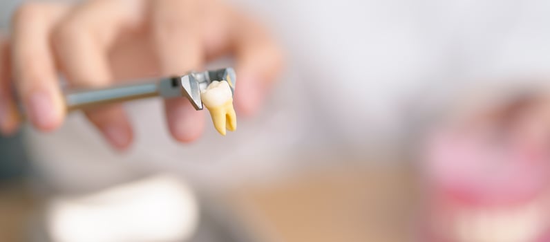 Dentist with tooth Anatomy model. Oral Teeth and disease, Scrape off tartar. March Oral health, Dentist Day, False Teeth. Toothache and Children Dental Health Month and Orthodontic Health Day photo