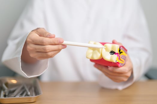 Dentist with tooth Anatomy model. Oral Teeth decay and disease, Scrape off tartar. March Oral health, Dentist Day, False Teeth. Toothache and Children Dental Health Month and Orthodontic Health Day photo