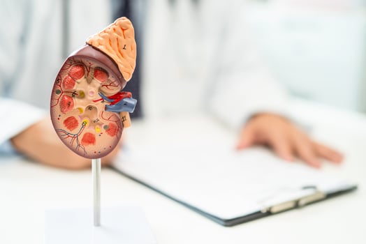 Kidney disease, Chronic kidney disease ckd, Doctor with human model to study and treat in hospital. photo