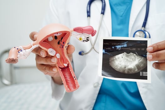 Uterus, doctor holding human anatomy model for study diagnosis and treatment in hospital. photo