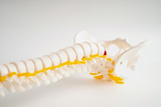 Spinal nerve and bone, Lumbar spine displaced herniated disc fragment, Model for treatment medical in the orthopedic department. photo