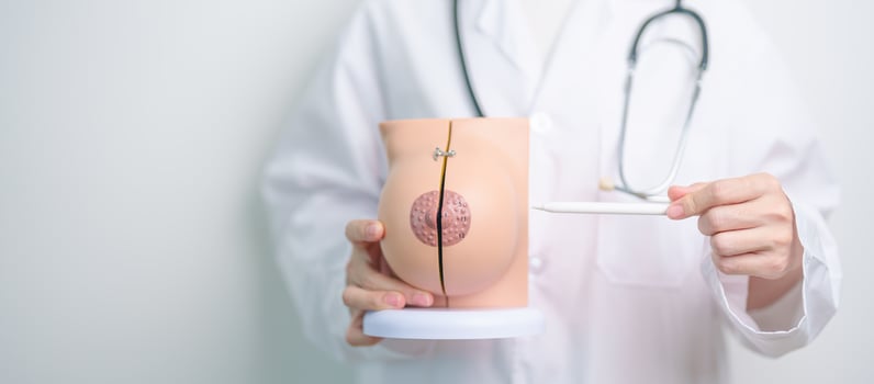 Doctor holding Breast Anatomy model. Breast Augmentation Surgery, October Breast Cancer Awareness month, implant, Diagnosis, Beauty woman enlargement and medical education concept photo