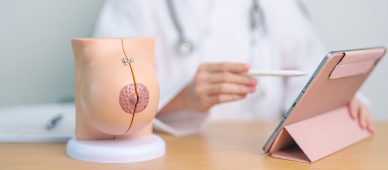 Doctor with Breast Anatomy model. Breast Augmentation Surgery, October Breast Cancer Awareness month, implant, Diagnosis, Beauty woman enlargement and medical education concept photo