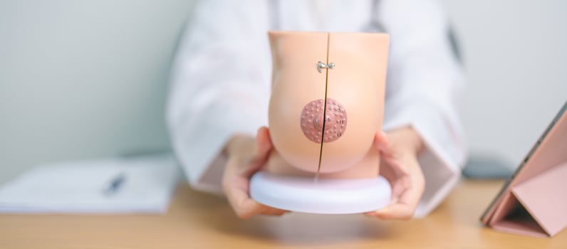 Doctor with Breast Anatomy model. Breast Augmentation Surgery, October Breast Cancer Awareness month, implant, Diagnosis, Beauty woman enlargement and medical education concept photo