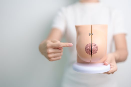 woman holding Breast Anatomy model. Breast Augmentation Surgery, October Breast Cancer Awareness month, implant, Diagnosis, Beauty woman enlargement and medical education concept photo