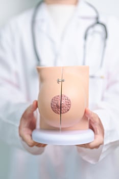 Doctor holding Breast Anatomy model. Breast Augmentation Surgery, October Breast Cancer Awareness month, implant, Diagnosis, Beauty woman enlargement and medical education concept photo
