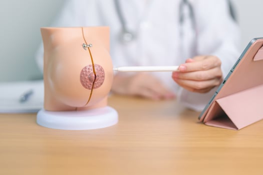Doctor with Breast Anatomy model. Breast Augmentation Surgery, October Breast Cancer Awareness month, implant, Diagnosis, Beauty woman enlargement and medical education concept photo