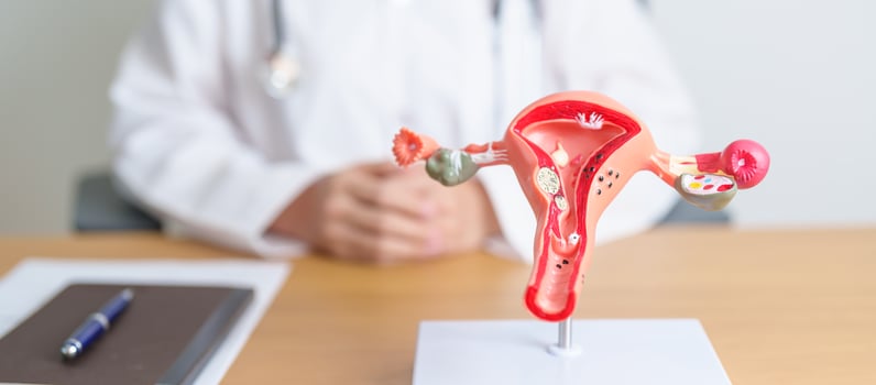 Doctor with Uterus and Ovaries anatomy model. Ovarian and Cervical cancer, Cervix disorder, Endometriosis, Hysterectomy, Uterine fibroids, Reproductive system, Pregnancy and health concept photo
