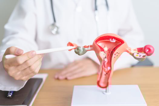 Doctor with Uterus and Ovaries anatomy model. Ovarian and Cervical cancer, Cervix disorder, Endometriosis, Hysterectomy, Uterine fibroids, Reproductive system, Pregnancy and health concept photo