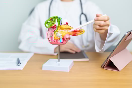 Doctor with human Pancreatitis anatomy model with Pancreas, Gallbladder, Bile Duct, Duodenum, Small intestine and tablet. Pancreatic cancer, acute pancreatitis and Digestive system photo