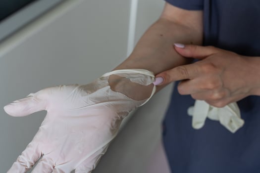 used glove with a hole in the medic's hand photo