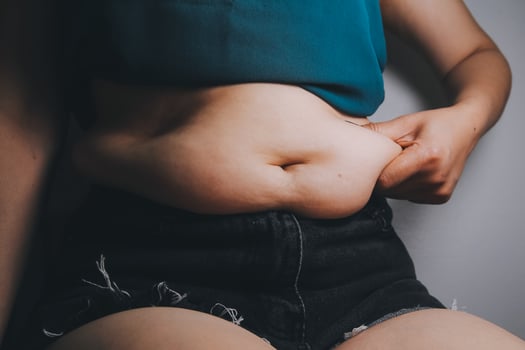 fat woman, fat belly, chubby, obese woman hand holding excessive belly fat with measure tape, woman diet lifestyle concept photo
