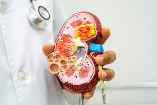 Cardiovascular disease CVD, Asian doctor holding human anatomy model for learn and treat heart disease. photo
