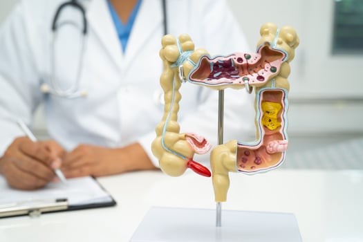 Intestine, appendix and digestive system, doctor holding anatomy model for study diagnosis and treatment in hospital. photo