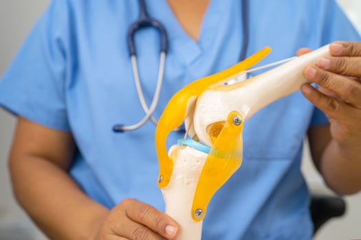 Osteoarthritis of the knee, Doctor holding human knee joint orthopedic anatomy model in hospital. photo