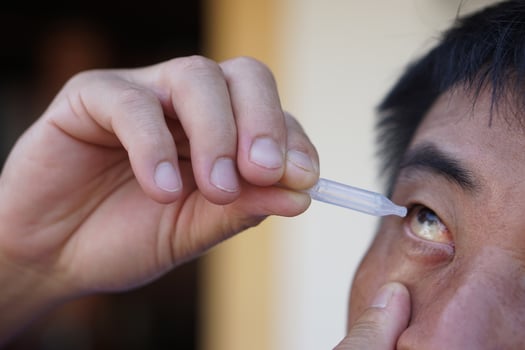 Close up hand hold tube of artificial tear lubricant eye drops with eyes. Concept, Healthcare. Treatment for dry eye symptoms, eye inflammation diseases. Relief irritated optics. photo