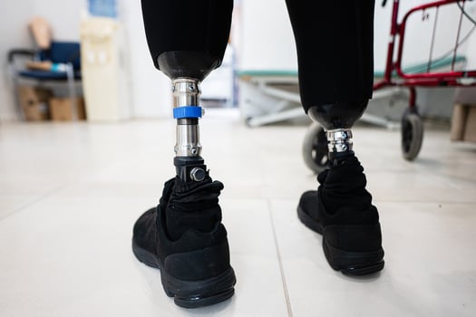 Close-up of prosthetic legs with athletic shoes indoors photo