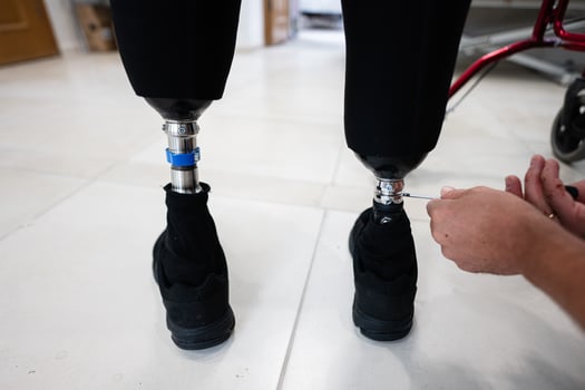 Technician adjusting prosthetic legs in a rehabilitation facility photo