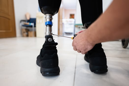 Technician adjusting prosthetic leg for a perfect fit photo