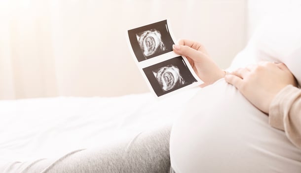 Pregnant woman holding ultrasound image of her baby and caressing her belly, lying in bed, empty space photo