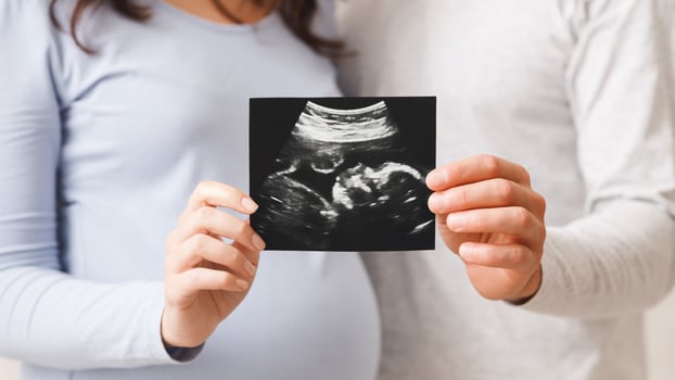 Birth Of New Life. Pregnant woman and her husband showing ultrasound scan of their baby, selective focus on hands with sonography photo
