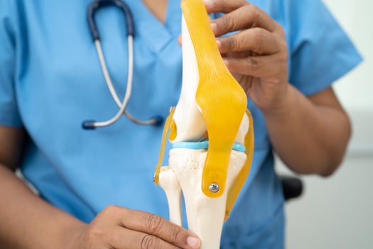 Osteoarthritis of the knee, Doctor holding human knee joint orthopedic anatomy model in hospital. photo