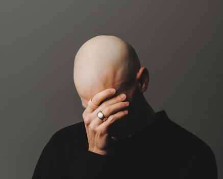 a bald man with his hands on his face photo