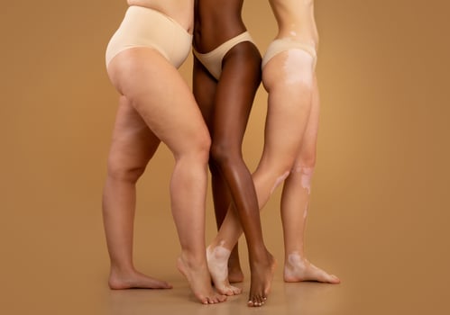 Every Body Is Beautiful. Tree women with different race and body sizes posing in underwear over beige background, cropped image with free space photo