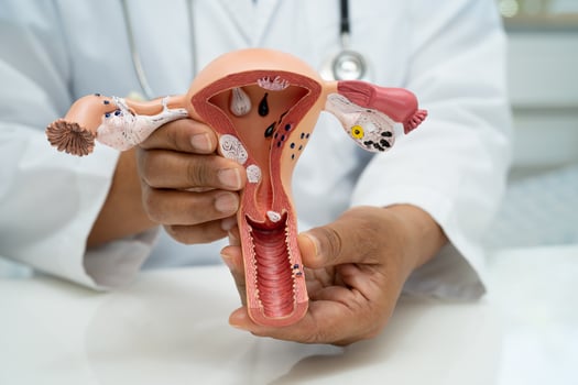 Uterus, doctor with anatomy model for study diagnosis and treatment in hospital. photo