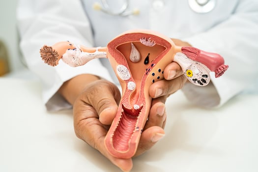 Uterus, doctor with anatomy model for study diagnosis and treatment in hospital. photo