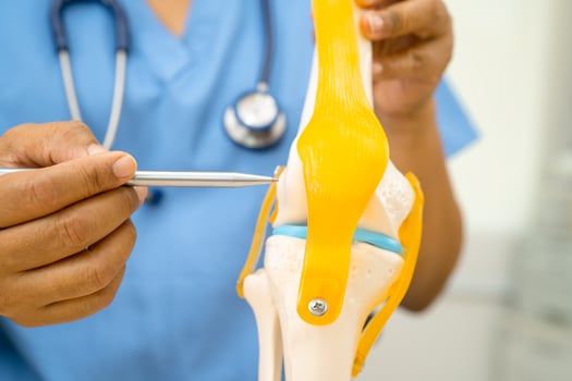 Osteoarthritis of the knee, Doctor holding human knee joint orthopedic anatomy model in hospital. photo