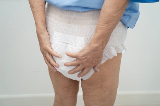 Asian senior woman patient wearing adult incontinence diaper pad in hospital. photo