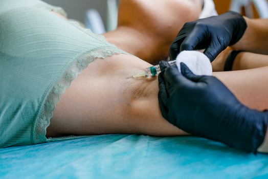 Cosmetic Injections for Armpit Beauty Enhancement at Salon photo