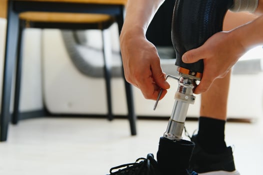 Man amputee with prosthetic leg disability on above knee transfemoral leg prosthesis artificial device, close up. People with amputation disabilities everyday life photo