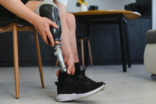 portrait of man with prosthetic leg sitting photo