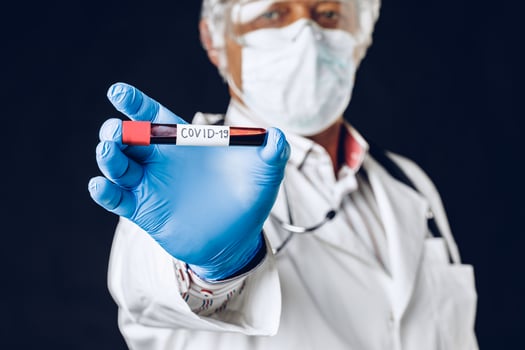 Infected blood sample COVID 19 in sample tube in hand of doctor. photo